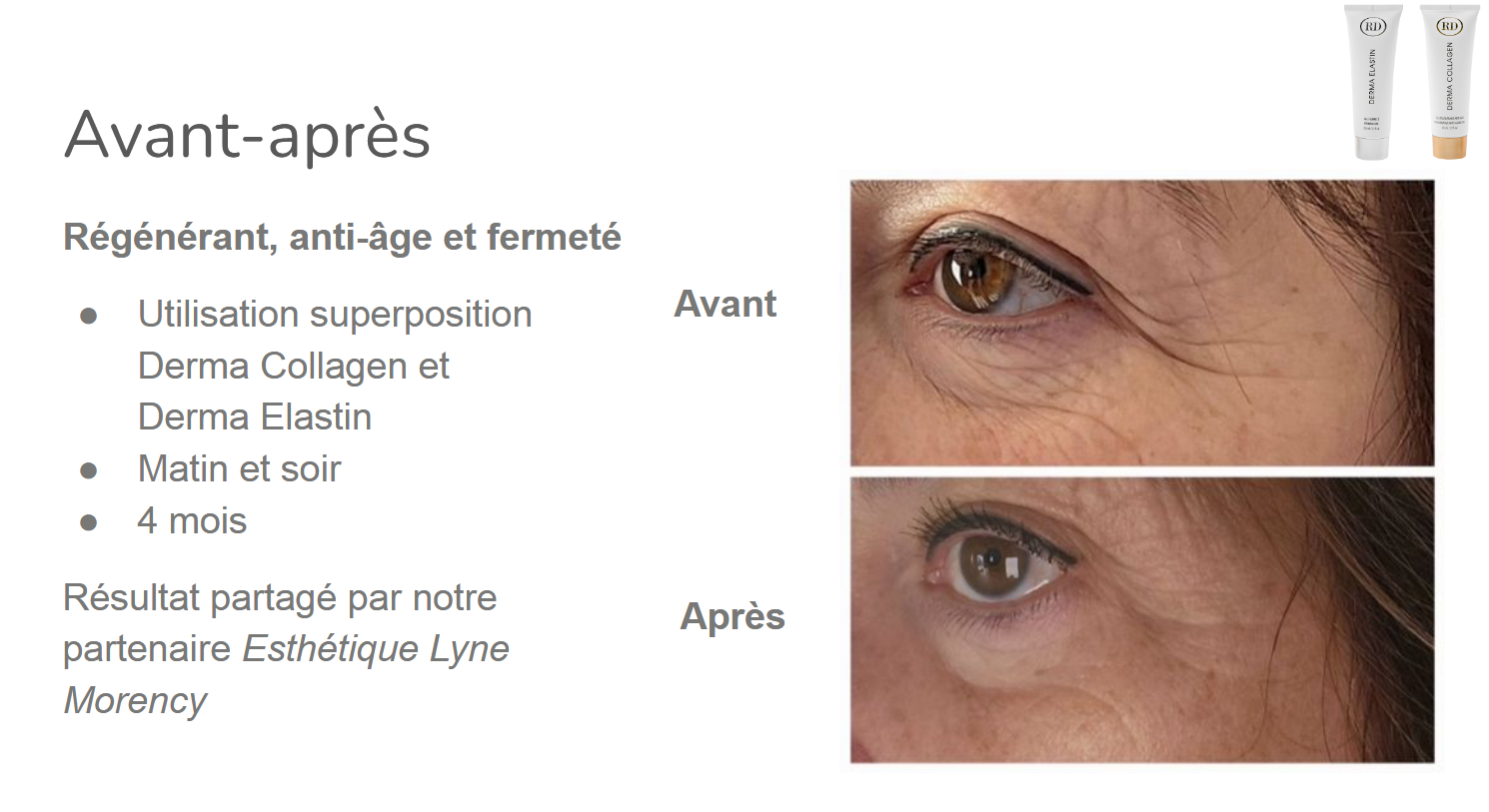 Sérum Yeux Age Proteom